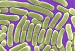 Salmonella Entérica Typhi: bactéria causadora da febre tifóide (imagem ampliada em microscópio)