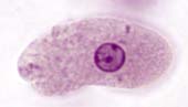 Entamoeba histolytica: causador da amebíase