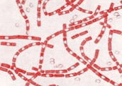 Bacillus anthracis: exemplo de bactéria que produz endósporos