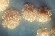Mycobacterium tuberculosis: bactéria causadoras da Tuberculose Pulmonar (imagem de microscópio)