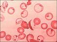 Células do sangue - imagem de microscópio