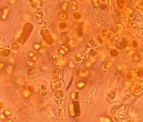Imagem de microscópio de uma colônia de cianobactérias