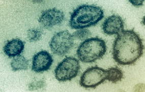 Imagem de microscópio do novo coronavírus
