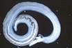 Parasita Shistosoma: causador da doença