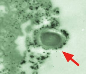 Imagem de um processo de fagocitose