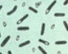 Bactéria do botulismo: imagem de microscópio