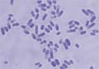 Escherichia Coli: bactéria é a principal causadora das infecções urinárias