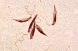 Protozoário Leishmania: causador da doença
