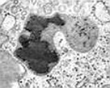 Lisossomos: importante função no processo de digestão intracelular (imagem de um lisossomo ampliada em microscópio)