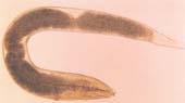 Enterobius vermicularis: também conhecido como oxiúrus