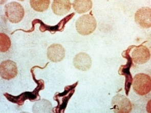 Imagem de microscópio do Trypanosoma cruzi