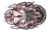 Sarcoptes scabiei: parasita causador da sarna (imagem de microscópio)