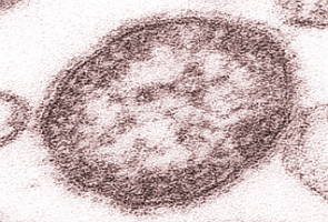 Vírus causador do sarampo