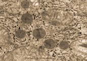 Peroxissomo: importante organela das células eucarióticas