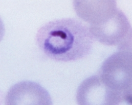 Imagem de um Plasmodium ovale