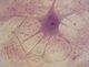 Célula nervosa, neurônio (imagem de microscópio).