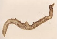 Schistosoma Mansoni: exemplo de tramatódeo
